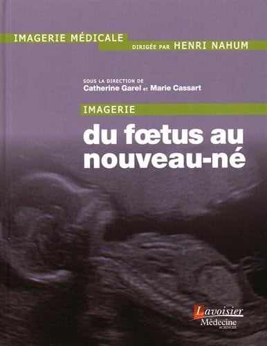 Imagerie du fœtus au nouveau-né
