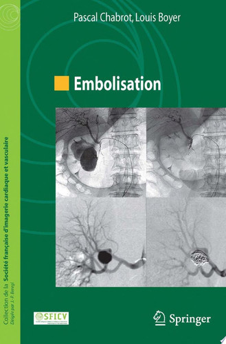 Embolisation