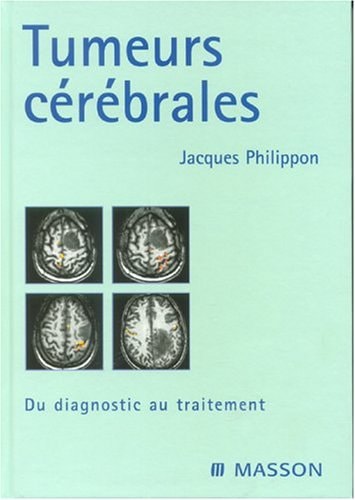Tumeurs cérébrales Du diagnostic au traitement