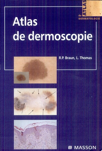 Atlas de dermoscopie