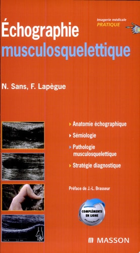 Echographie musculosquelettique