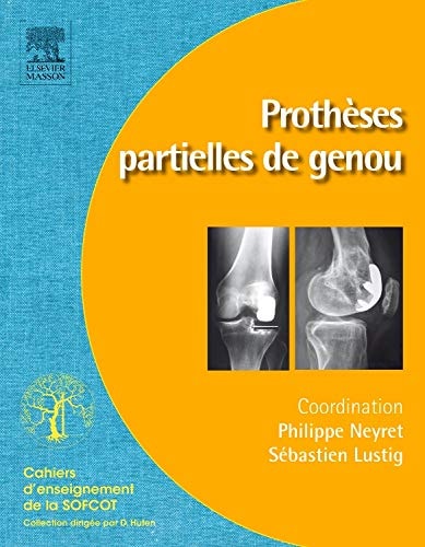 Prothèses partielles de genou