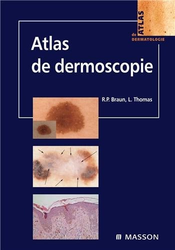 Atlas de dermoscopie