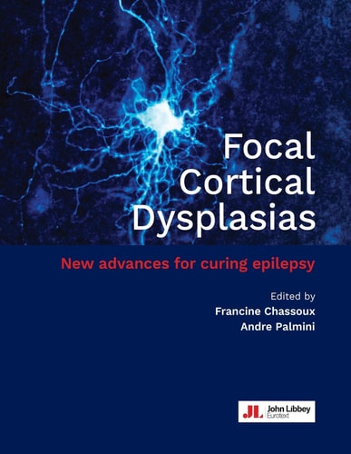 Focal Cortical Dysplasias New Advances for Curing Epilepsy