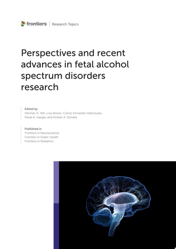 Perspectives and Recent Advances in Fetal Alcohol Spectrum Disorders Research