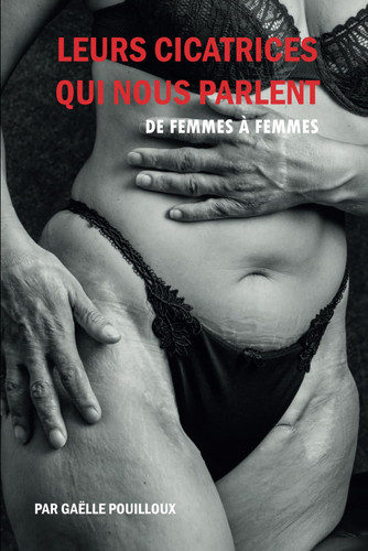 Leurs cicatrices qui nous parlent: De femmes à femmes (French Edition)
