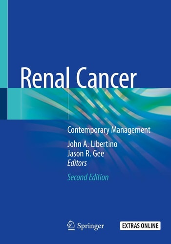 Renal Cancer Contemporary Management