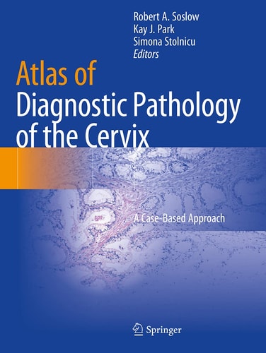 Atlas of Diagnostic Pathology of the Cervix A Case-Based Approach