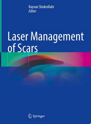 Laser Management of Scars