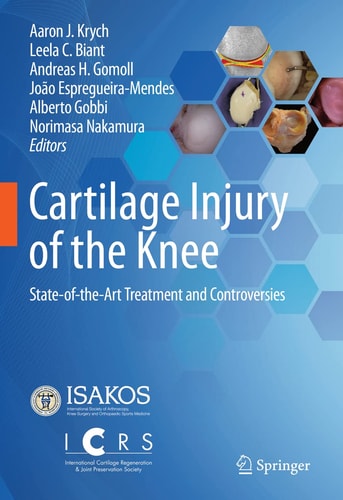 Cartilage Injury of the Knee State-of-the-Art Treatment and Controversies