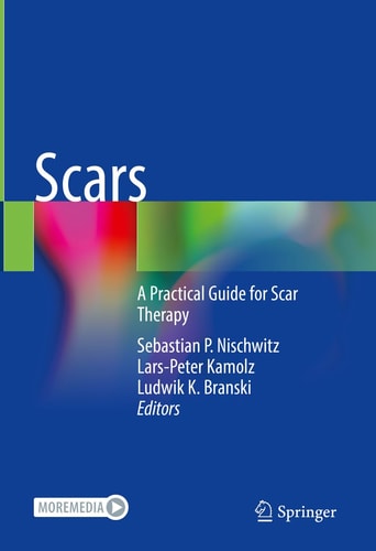 Scars A Practical Guide for Scar Therapy