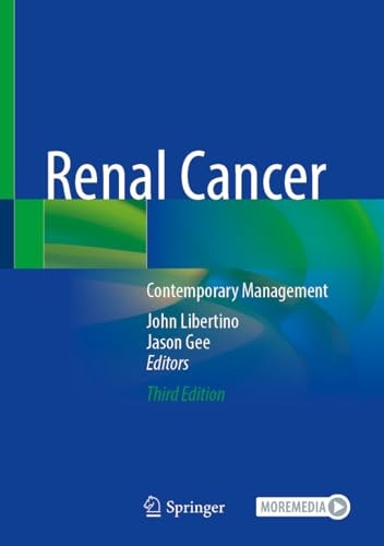 Renal Cancer Contemporary Management