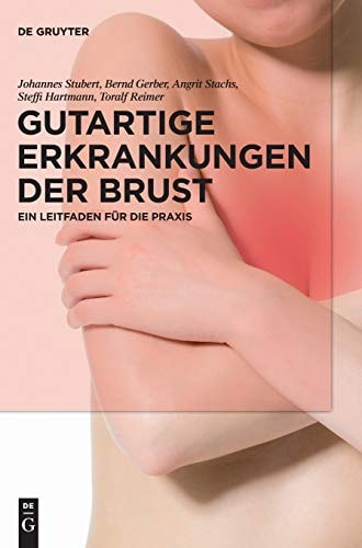 Gutartige Erkrankungen der Brust ein Leitfaden für die Praxis