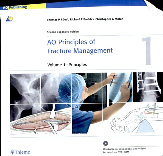AO Principles of Fracture Management