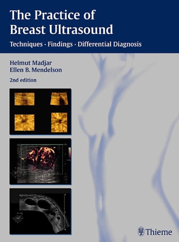 The Practice of Breast Ultrasound Techniques, Findings, Differential Diagnosis