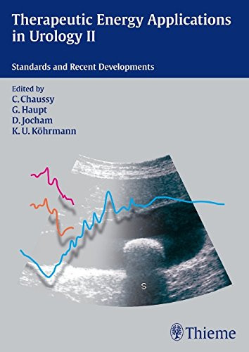 Therapeutic Energy Applications in Urology II: Standards and Recent Deve