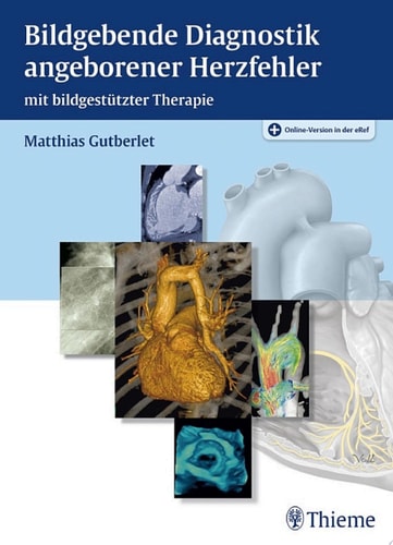 Bildgebende Diagnostik angeborener Herzfehler mit bildgestützter Therapie