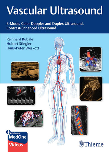 Vascular Ultrasound B-Mode, Color Doppler and Duplex Ultrasound, Contrast-Enhanced Ultrasound