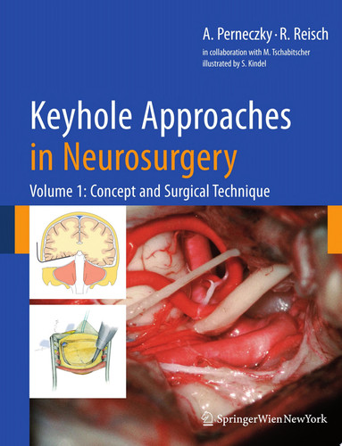 Keyhole Approaches in Neurosurgery