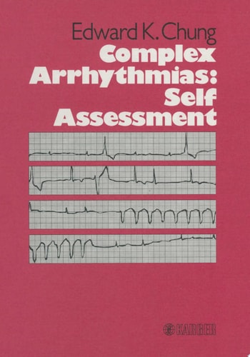 Complex Arrhythmias: Self Assessment