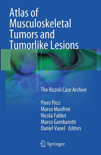 Atlas of Musculoskeletal Tumors and Tumorlike Lesions The Rizzoli Case Archive