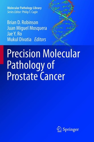 Precision Molecular Pathology of Prostate Cancer