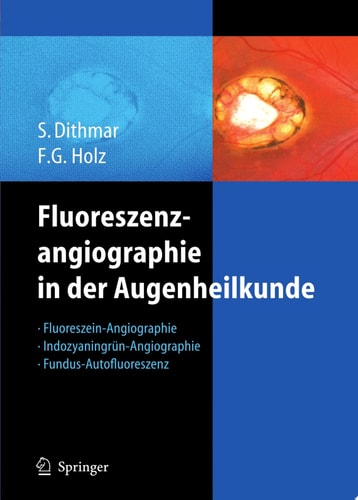 Fluoreszenzangiographie in der Augenheilkunde