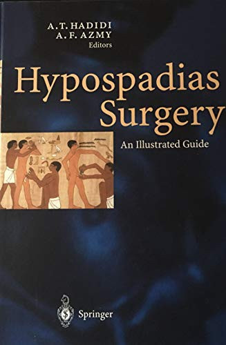 Hypospadias Surgery An Illustrated Guide