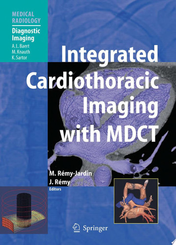 Integrated Cardiothoracic Imaging with MDCT
