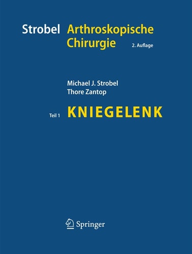 Strobel Arthroskopische Chirurgie Teil I: Kniegelenk