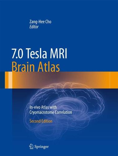 7.0 Tesla MRI Brain Atlas In-vivo Atlas with Cryomacrotome Correlation