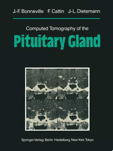 Computed Tomography of the Pituitary Gland With a Chapter on Magnetic Resonance Imaging of the Sellar and Juxtasellar Region, By M. Mu Huo Teng and K. Sartor