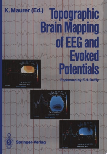 Topographic Brain Mapping of EEG and Evoked Potentials