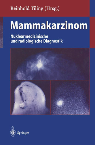 Mammakarzinom Nuklearmedizinische und radiologische Diagnostik