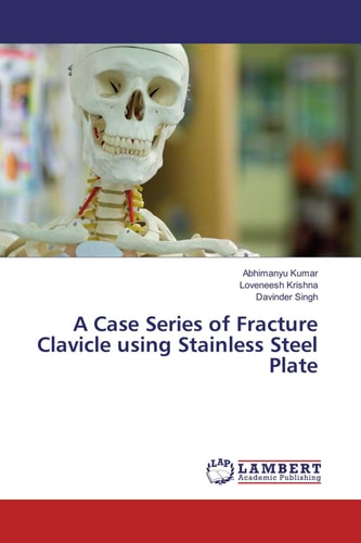 A Case Series of Fracture Clavicle Using Stainless Steel Plate