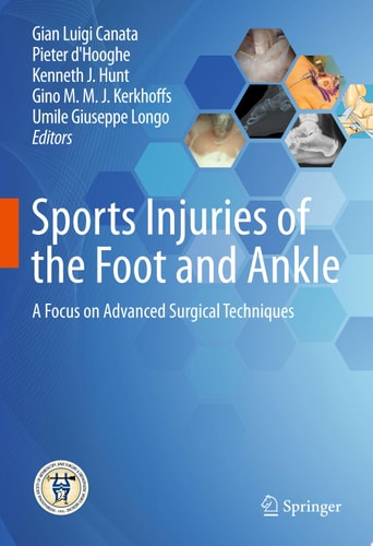 Sports Injuries of the Foot and Ankle