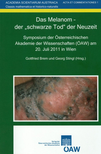 “Das” Melanom - der "schwarze Tod" der Neuzeit Symposium der Österreichischen Akademie der Wissenschaften (ÖAW) am 20. Juli 2011 in Wien ; mit ... 11 Tabellen