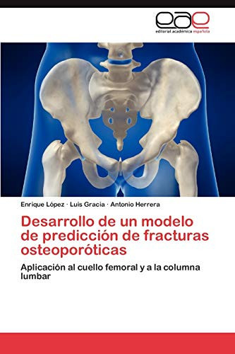 Desarrollo de Un Modelo de Predicción de Fracturas Osteoporóticas