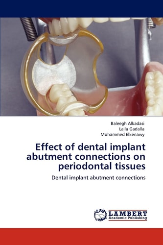 Effect of Dental Implant Abutment Connections on Periodontal Tissues
