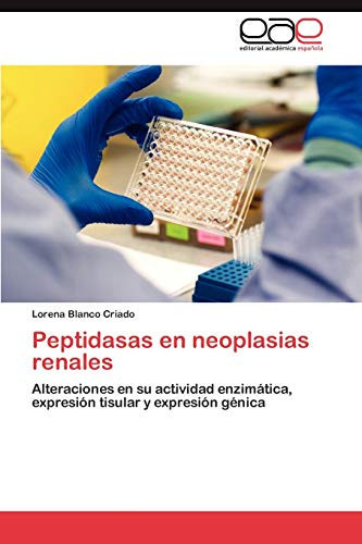 Peptidasas en Neoplasias Renales