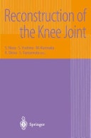 Reconstruction of the Knee Joint