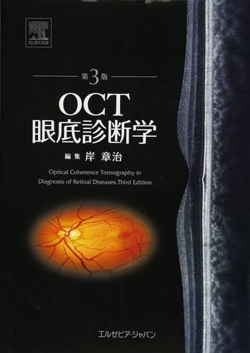OCT