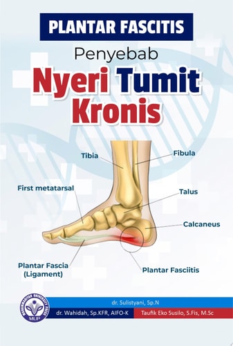 Plantar Fascitis Penyebab Nyeri Tumit Kronis