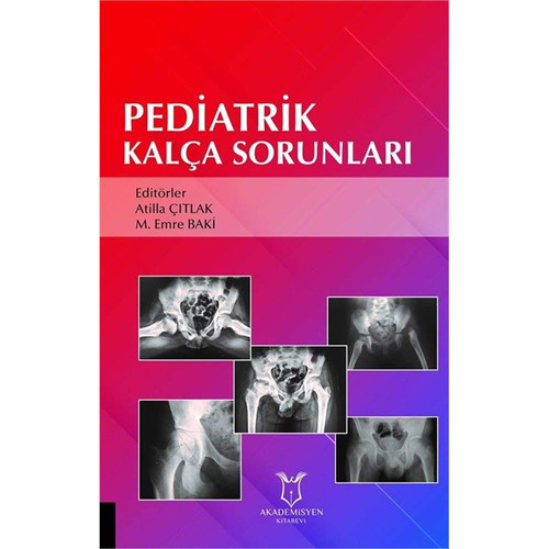 Pediatrik Kalça Sorunları