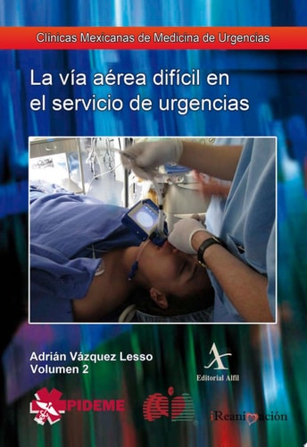 La intubación de secuencia rápida