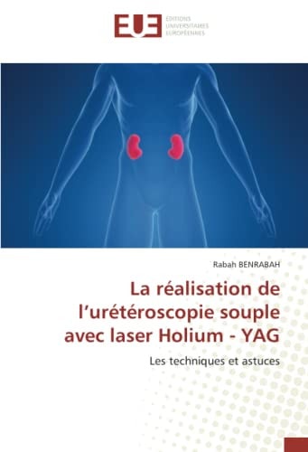 La réalisation de l’urétéroscopie souple avec laser Holium - YAG: Les techniques et astuces (French Edition)