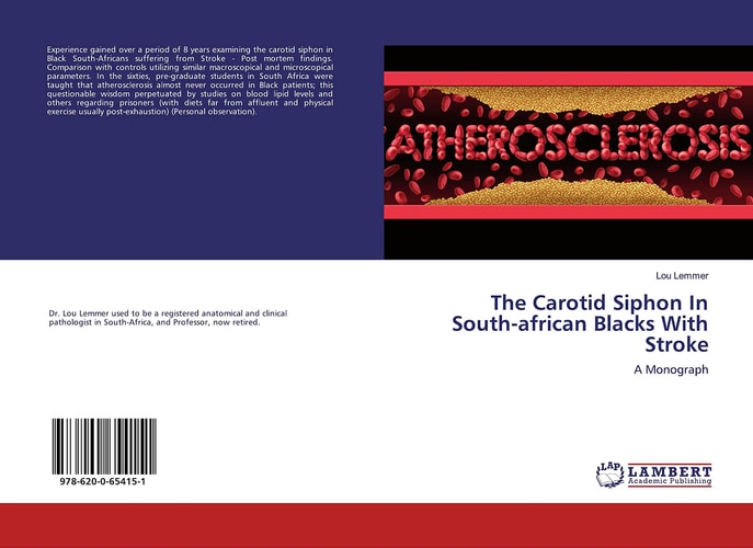 The Carotid Siphon In South-african Blacks With Stroke: A Monograph