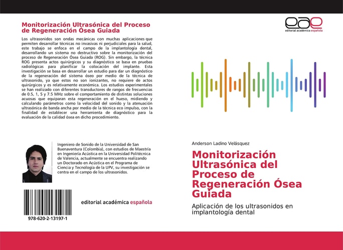 Monitorización Ultrasónica del Proceso de Regeneración Ósea Guiada: Aplicación de los ultrasonidos en implantología dental (Spanish Edition)