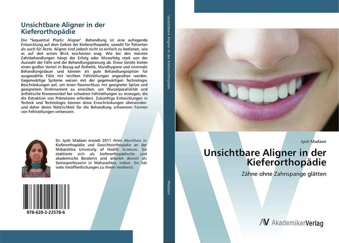 Unsichtbare Aligner in der Kieferorthopädie: Zähne ohne Zahnspange glätten (German Edition)