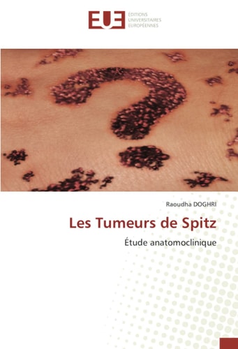 Les Tumeurs de Spitz: Étude anatomoclinique (French Edition)